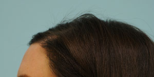 long term side effects of celexa long term side effects of celexa