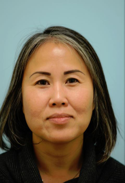 Eyebrow Hair Restoration