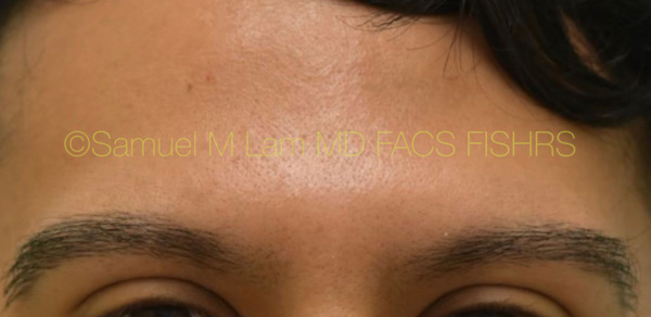 Ethnic Hair Restoration