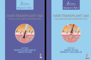 Hair Transplant Book Cover, Hybrid FUE, Dallas TX