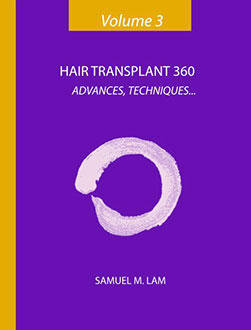 Hair Transplant 360