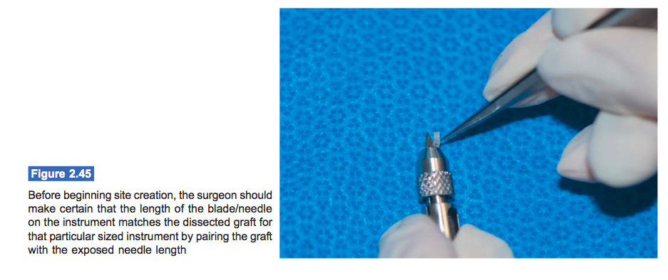 graft-to-site-fit-hair-transplant