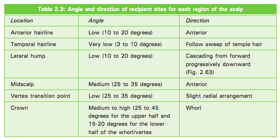 Hair Angle Directions for Hair Transplant
