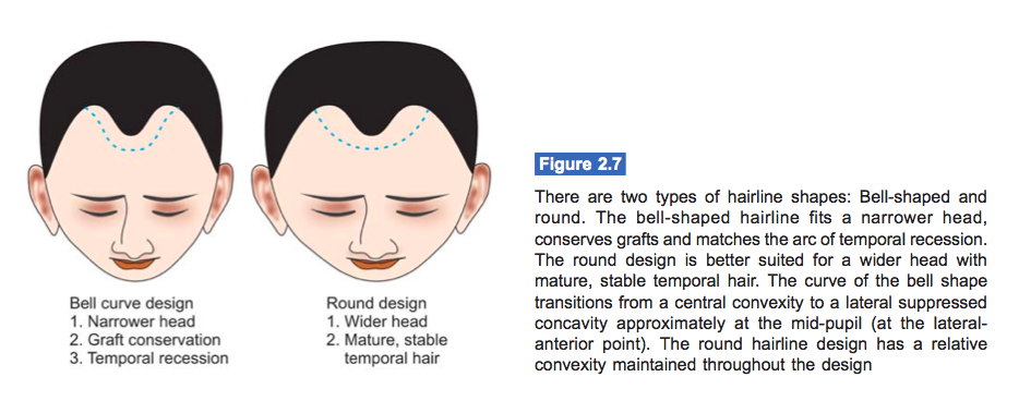 hairline shapes for hair transplant