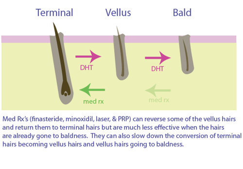 Hair Graphic for PRP and ACell