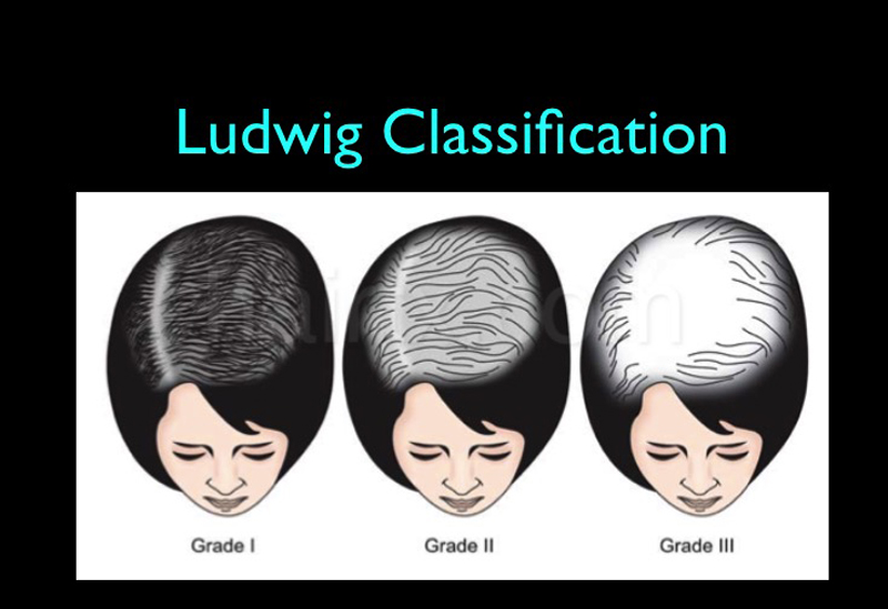 Ludwig Classification Plano Tx