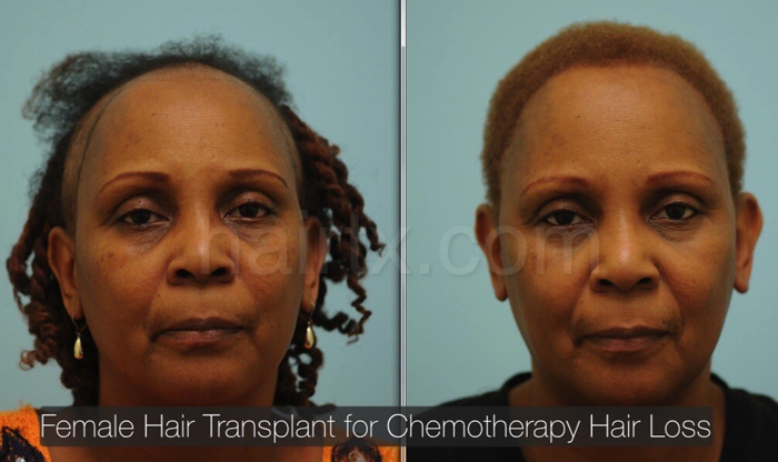 African american wigs in dallas tx hotsell