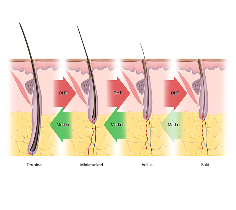 Non-Surgical Therapies