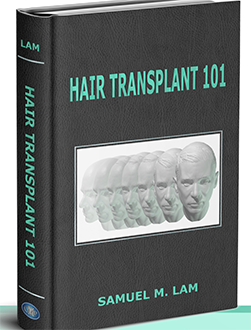 Hair Transplant 101