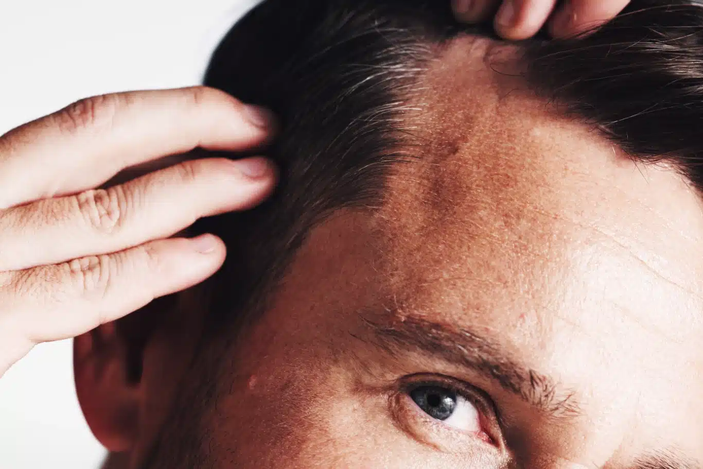 Hairline growth and closeup with man a man examining his hairline for signs of thinning or hair loss.